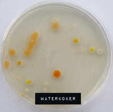 Waterkoker microben